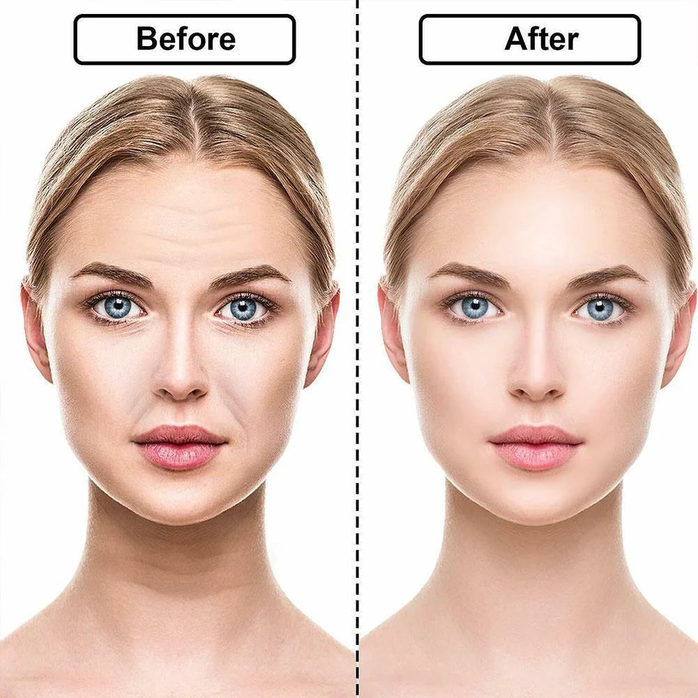 ✨Silicone Anti-Wrinkle Patches – Look 10 to 20 Years Younger Instantly! ✨