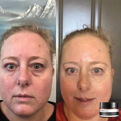 1+1 FREE | EverYouth™ Unlock the Fountain of Youth Today!