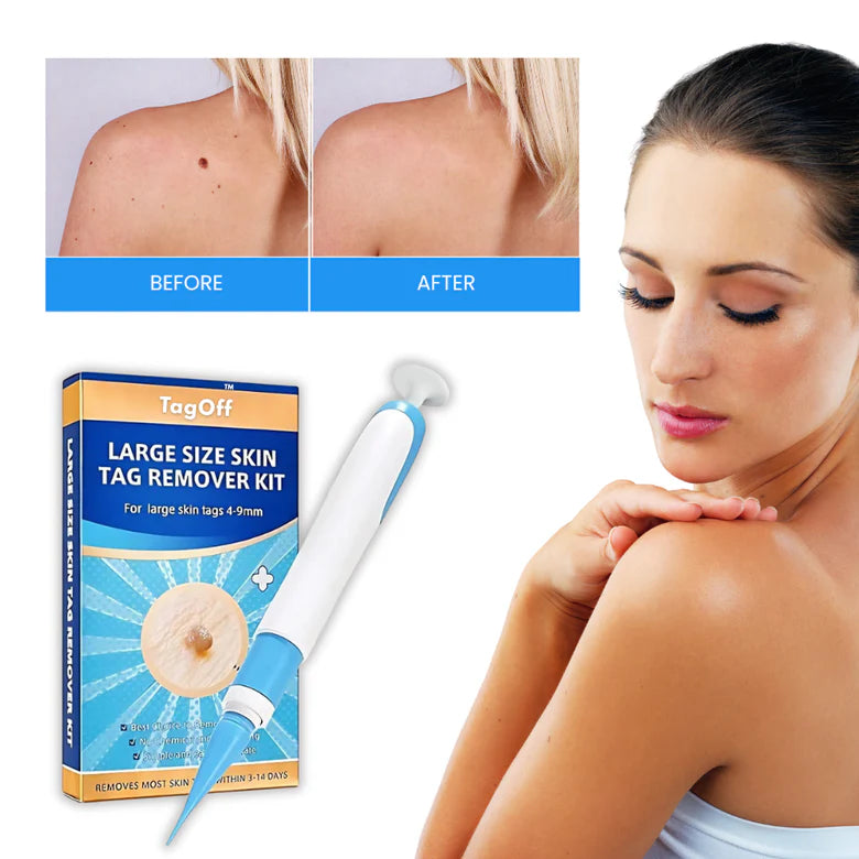 ✨ DermaErase™ Rapid Skin Tag Remover