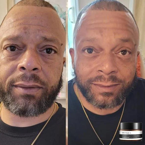 1+1 FREE | EverYouth™ Unlock the Fountain of Youth Today!