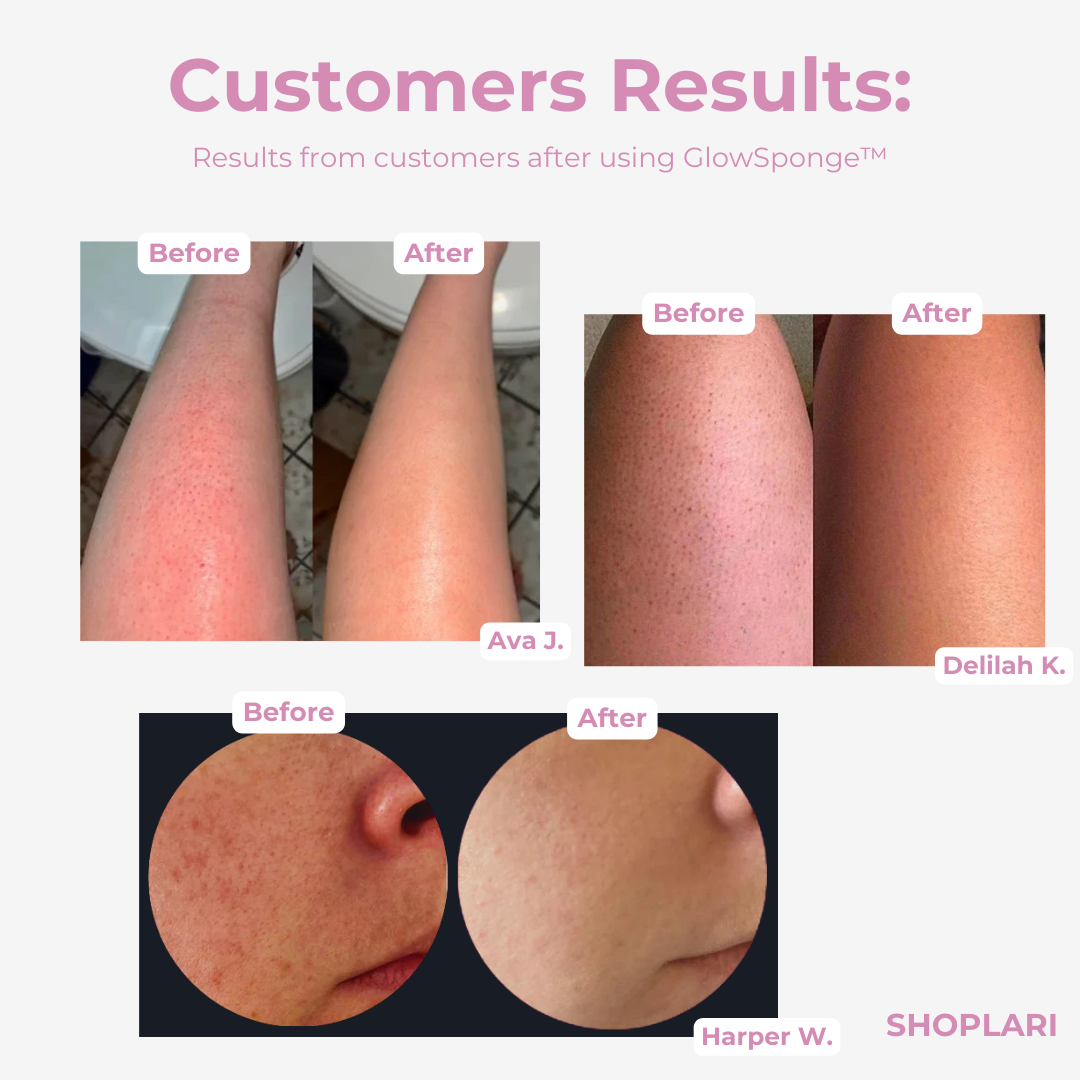 Último Día: 1+2 GRATIS🔥 | Esponja Exfoliante para Cuerpo GlowSponge™