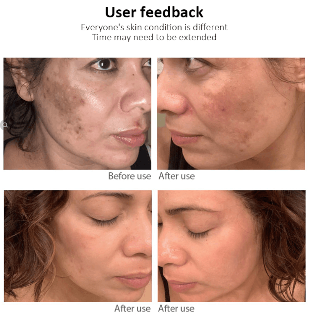 Whitening Freckle Cream Face Moisturizing Face Skin Care