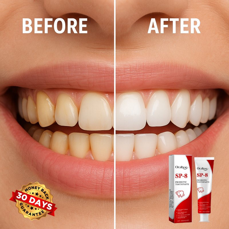 SmilePro™ SP-8 Probiotic Whitening Toothpaste