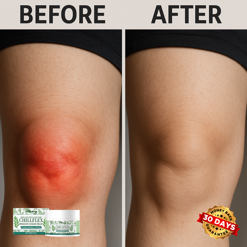 JointEase™ Herbal Relief Cream