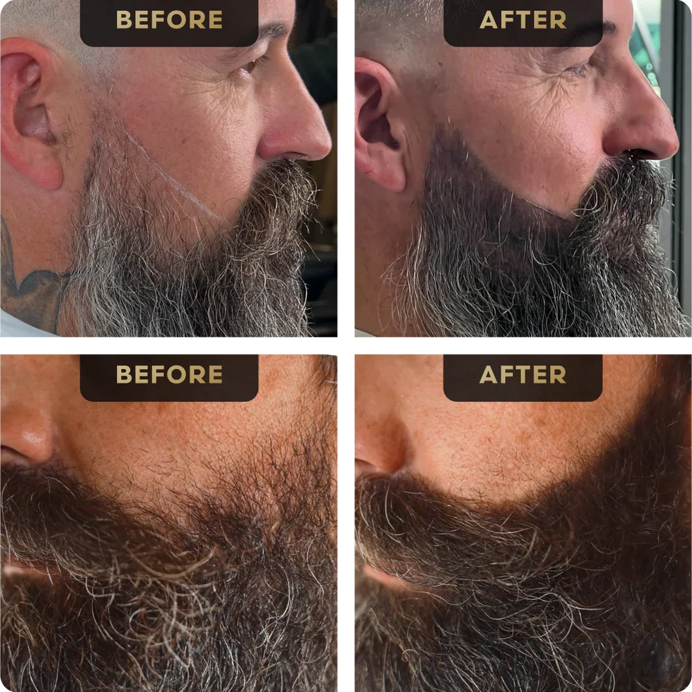 BeardFix™ — Fill patchy spots fast with our sweatproof precision pen