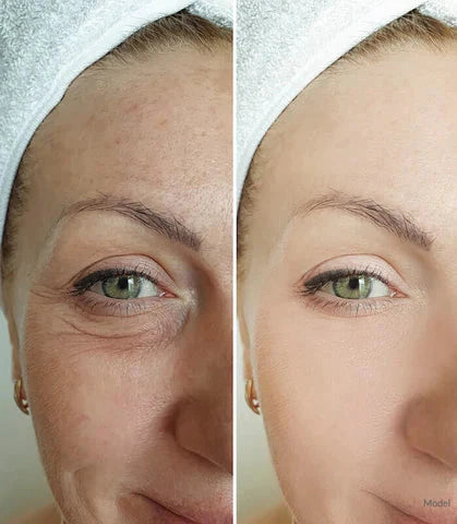 Anti-aging & wrinkle-removing eye cream