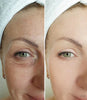 Anti-aging & wrinkle-removing eye cream